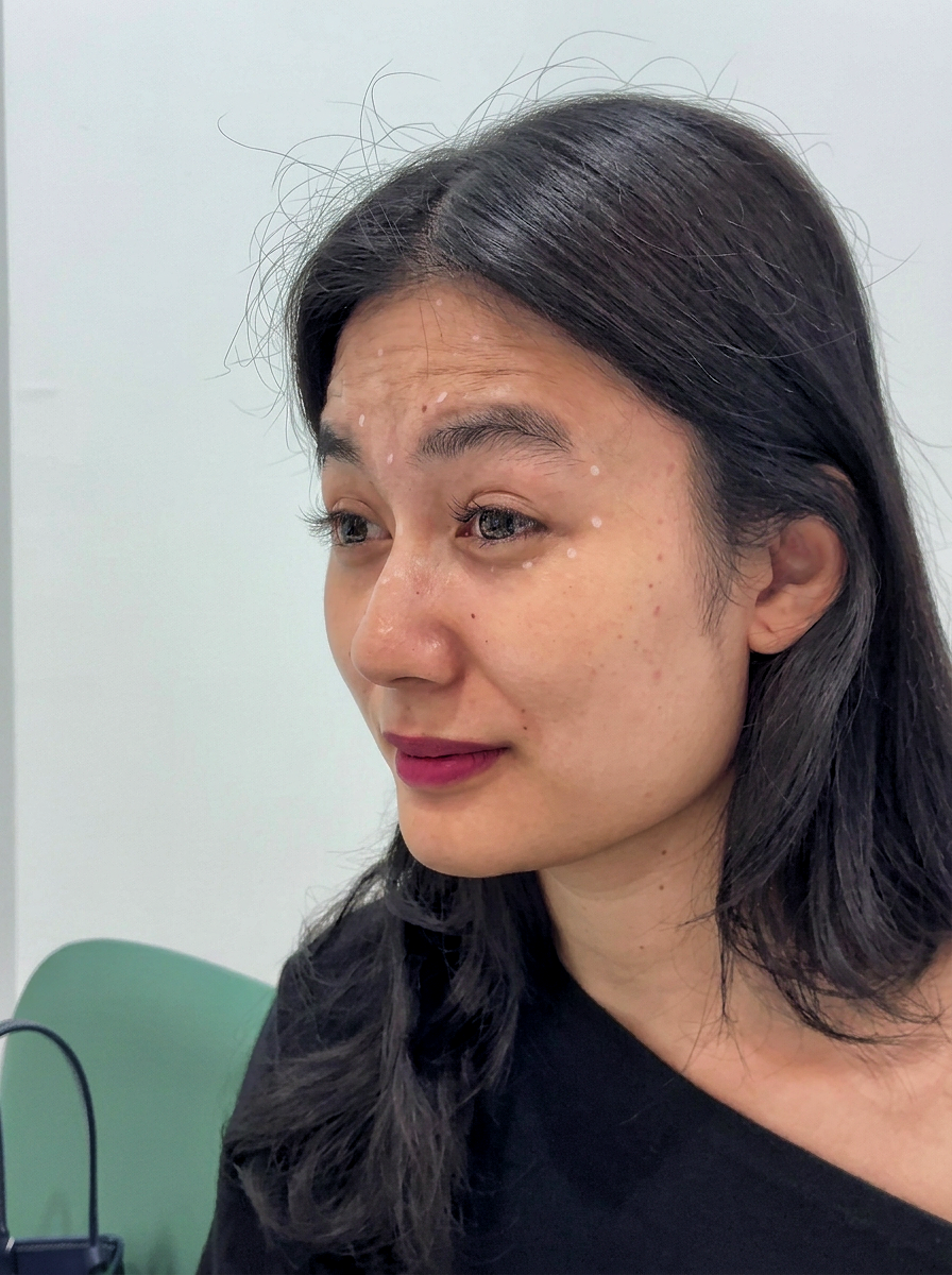 Age-Reset Shot treatment